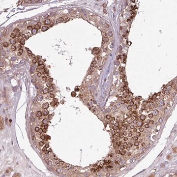 Anti-PDPR antibody produced in rabbit Prestige Antibodies&#174; Powered by Atlas Antibodies, affinity isolated antibody, buffered aqueous glycerol solution