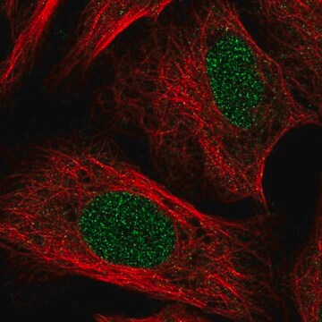 Anti-TOX antibody produced in rabbit Prestige Antibodies&#174; Powered by Atlas Antibodies, affinity isolated antibody