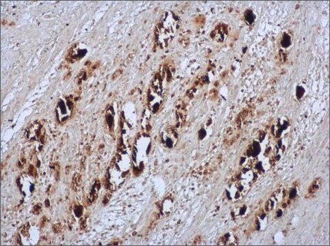 Anti-EV71 antibody produced in rabbit