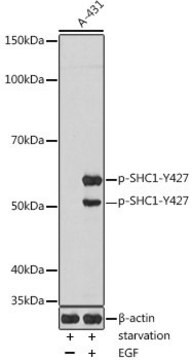 Anti-Phospho-SHC1-Y427