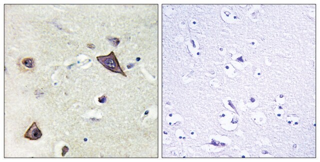 Anti-NMDAR1 antibody produced in rabbit affinity isolated antibody