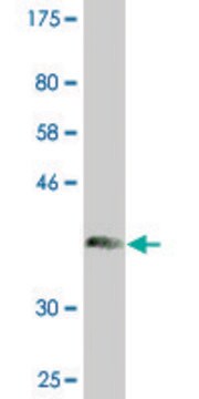 Monoclonal Anti-CHIT1 antibody produced in mouse clone 1D11, purified immunoglobulin, buffered aqueous solution