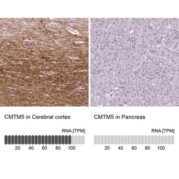 Anti-CMTM5 antibody produced in rabbit Prestige Antibodies&#174; Powered by Atlas Antibodies, affinity isolated antibody, buffered aqueous glycerol solution