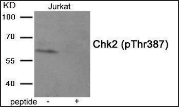 Anti-phospho-Chk2 (pThr387) antibody produced in rabbit affinity isolated antibody