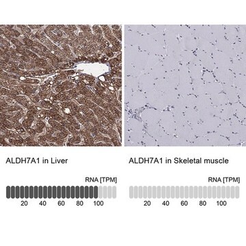 Anti-ALDH7A1 antibody produced in rabbit Prestige Antibodies&#174; Powered by Atlas Antibodies, affinity isolated antibody, buffered aqueous glycerol solution