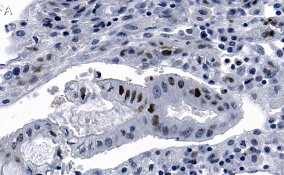 Anti-phospho-Chk2-Thr68 Antibody, clone 1B17 ZooMAb&#174; Rabbit Monoclonal recombinant, expressed in HEK 293 cells