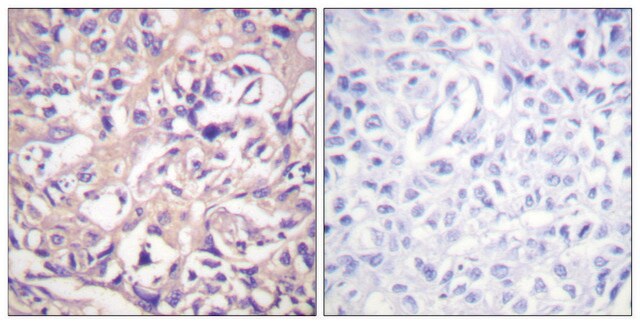 Anti-TK antibody produced in rabbit affinity isolated antibody