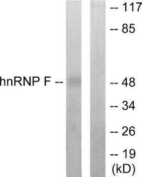 Anti-HNRNP F antibody produced in rabbit affinity isolated antibody