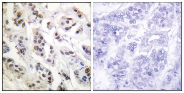 Anti-Lamin A antibody produced in rabbit affinity isolated antibody