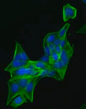 N27-A dopaminerge neurale Zelllinie der Ratte N27-A rat dopaminergic neural cell line is a suitable model for Parkinson&#8217;s disease research.