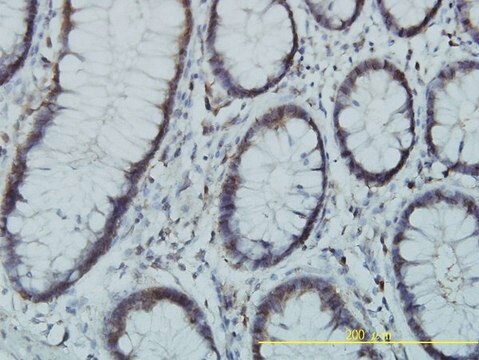 Monoclonal Anti-PGM3 antibody produced in mouse clone 1E2-1B12, purified immunoglobulin, buffered aqueous solution