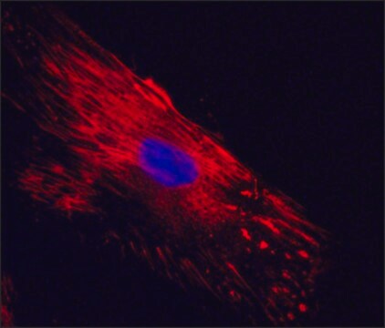 Przeciwciało przeciwfibronektynie komórkowej, mysie monoklonalne clone FN-3E2, hybridoma cell culture supernatant