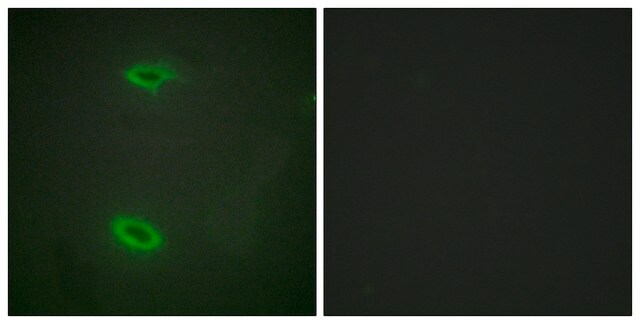 Anti-DLGP1 antibody produced in rabbit affinity isolated antibody