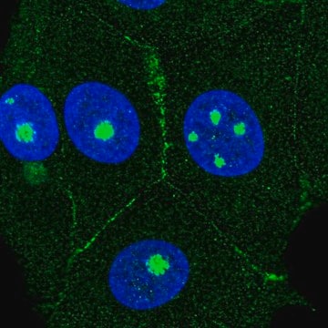 Anti-AGER antibody produced in rabbit Prestige Antibodies&#174; Powered by Atlas Antibodies, affinity isolated antibody