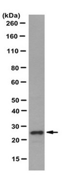 Anti-Sigma IR Antibody, clone ICR-SIG1R-A clone ICR-SIG1R-A, from rat