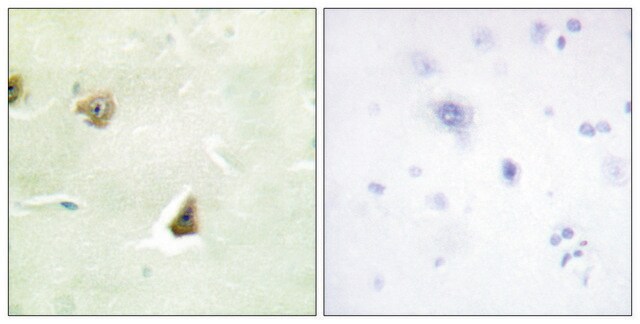 Anti-DUSP6 antibody produced in rabbit affinity isolated antibody