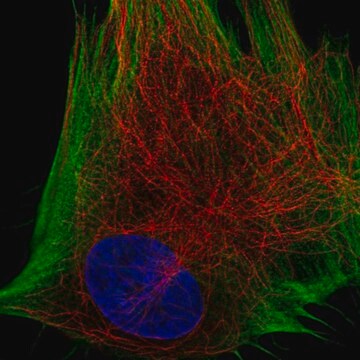 Anti-DDR2 antibody produced in rabbit Prestige Antibodies&#174; Powered by Atlas Antibodies, affinity isolated antibody