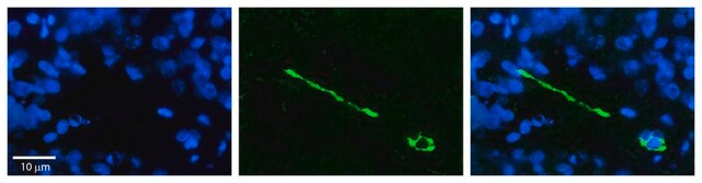 Anti-MTUS1 antibody produced in rabbit affinity isolated antibody