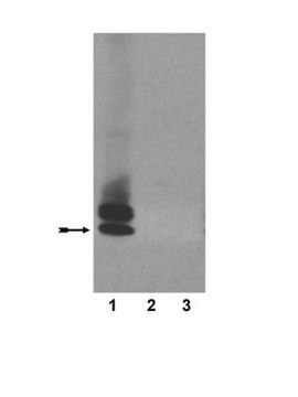 Anti-Amyloid &#946; (A&#946;)x-40 Antibody, clone 11A5-B10 ascites fluid, clone 11A5-B10, Upstate&#174;