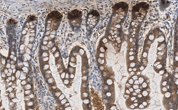 Anti-E-Cadherin Antibody, clone 1G14 ZooMAb&#174; Rabbit Monoclonal recombinant, expressed in HEK 293 cells