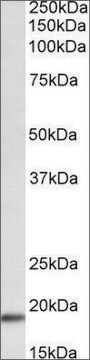 Anti-Wfdc1 antibody produced in goat affinity isolated antibody, buffered aqueous solution