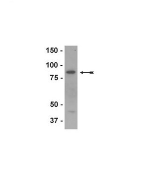 Anti-Lactotransferrin Antibody unpurified, Upstate&#174;