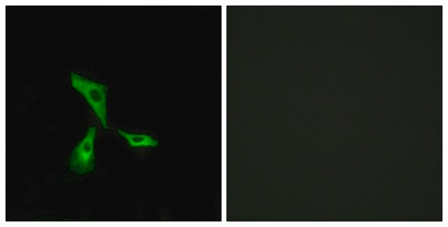 Anti-GPR101 antibody produced in rabbit affinity isolated antibody