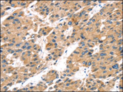 Anti-TRPV5 affinity isolated antibody