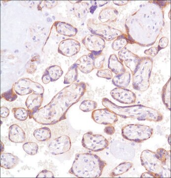 Anti-Glypican-3 antibody, Rabbit monoclonal clone SP86, recombinant, expressed in proprietary host, affinity isolated antibody