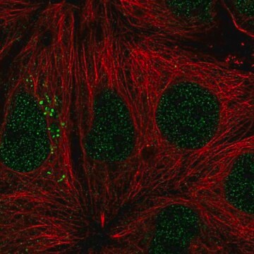 Anty-ST14 Prestige Antibodies&#174; Powered by Atlas Antibodies, affinity isolated antibody