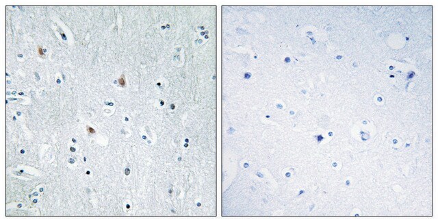 Anti-SOX12 antibody produced in rabbit affinity isolated antibody