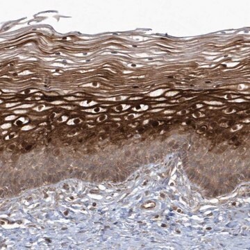 Anti-ARMC8 antibody produced in rabbit Prestige Antibodies&#174; Powered by Atlas Antibodies, affinity isolated antibody, buffered aqueous glycerol solution