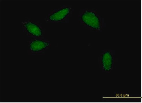 Anti-HNF1B antibody produced in mouse purified immunoglobulin, buffered aqueous solution