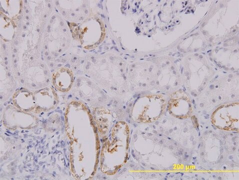 Monoclonal Anti-SLC25A11 antibody produced in mouse clone 3G4, purified immunoglobulin, buffered aqueous solution