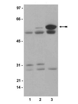 Anticorps anti-phospho-Src (Tyr416), clone 9A6 clone 9A6, Upstate&#174;, from mouse