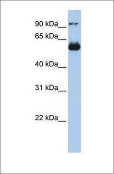 Anti-ETS2 (ab1) antibody produced in rabbit affinity isolated antibody