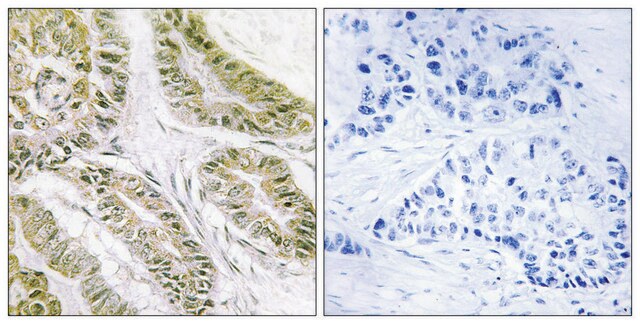 Anti-BAX antibody produced in rabbit affinity isolated antibody