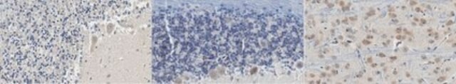 Anti-PSD95 Antibody, clone 3H4.3 clone 3H4.3, from mouse