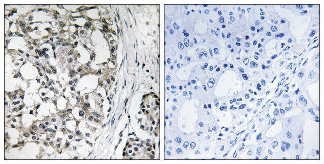 Anti-PEX14 antibody produced in rabbit affinity isolated antibody