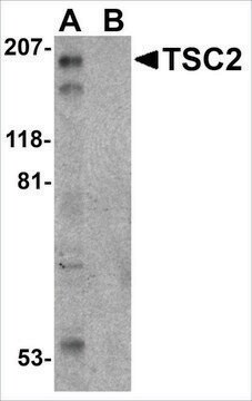 Anti-TSC2 (ab1) antibody produced in rabbit affinity isolated antibody, buffered aqueous solution