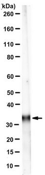 Anti-Ketohexokinase Isoform C Antibody, clone 5F1-3F5 clone 5F1-3F5, from mouse