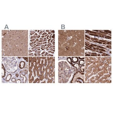 Anti-ATP5H antibody produced in rabbit Prestige Antibodies&#174; Powered by Atlas Antibodies, affinity isolated antibody, buffered aqueous glycerol solution