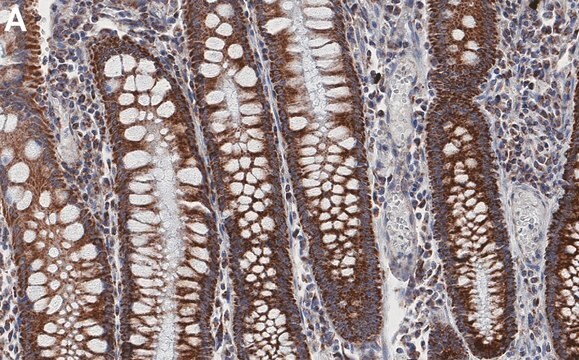 Anti-TOMM20 Antibody, clone 2F8.1 ZooMAb&#174; Mouse Monoclonal recombinant, expressed in HEK 293 cells