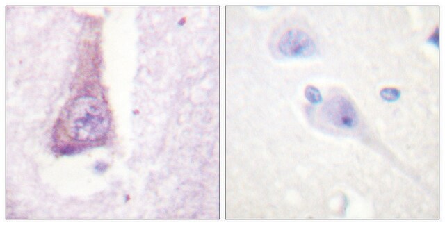 Anti-WASP antibody produced in rabbit affinity isolated antibody