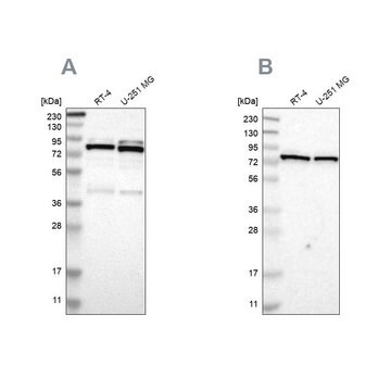 Anti-PARN antibody produced in rabbit Ab1, Prestige Antibodies&#174; Powered by Atlas Antibodies, affinity isolated antibody, buffered aqueous glycerol solution