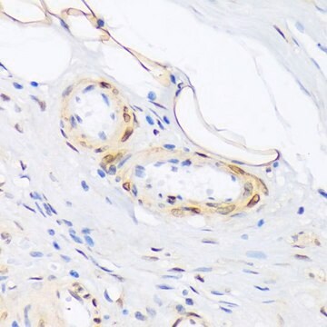 Anti-Phospho-PLN-T17 antibody produced in rabbit