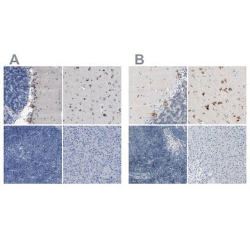 Anti-B4GALNT1 antibody produced in rabbit Prestige Antibodies&#174; Powered by Atlas Antibodies, affinity isolated antibody, buffered aqueous glycerol solution