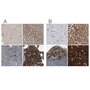 Anti-SSR1 antibody produced in rabbit Prestige Antibodies&#174; Powered by Atlas Antibodies, affinity isolated antibody, buffered aqueous glycerol solution