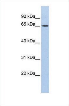 抗WT1抗体 ウサギ宿主抗体 affinity isolated antibody