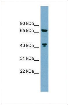 Anti-GLS antibody produced in rabbit affinity isolated antibody